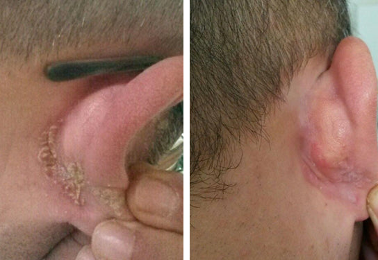 Quali sono i motivi per cui si manifesta la psoriasi?