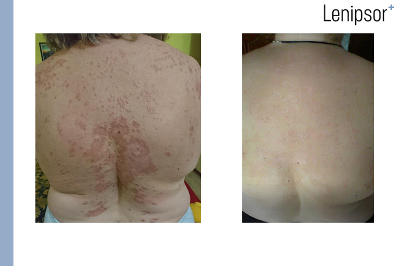 BioActive GEL Lenipsor+® 100 ml