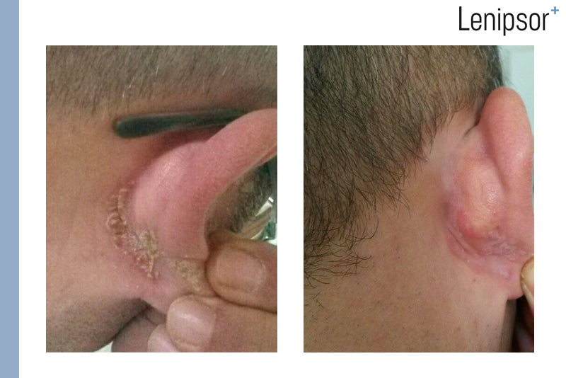 BioActive GEL Lenipsor+® 100 ml