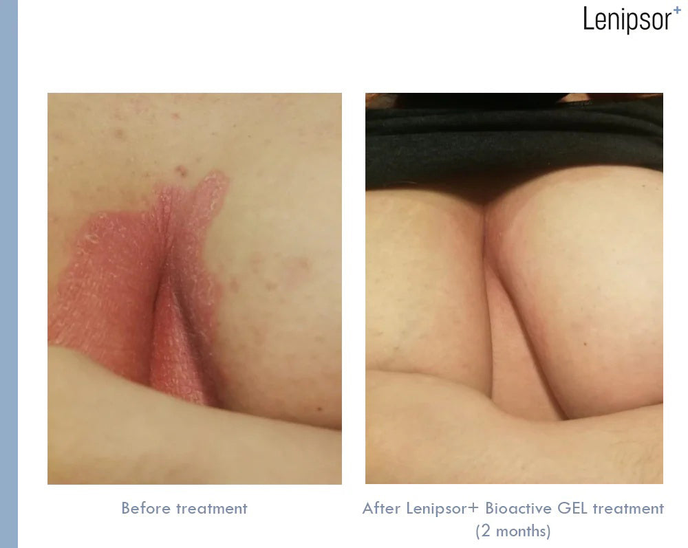 BioActive GEL Lenipsor+® 100 ml