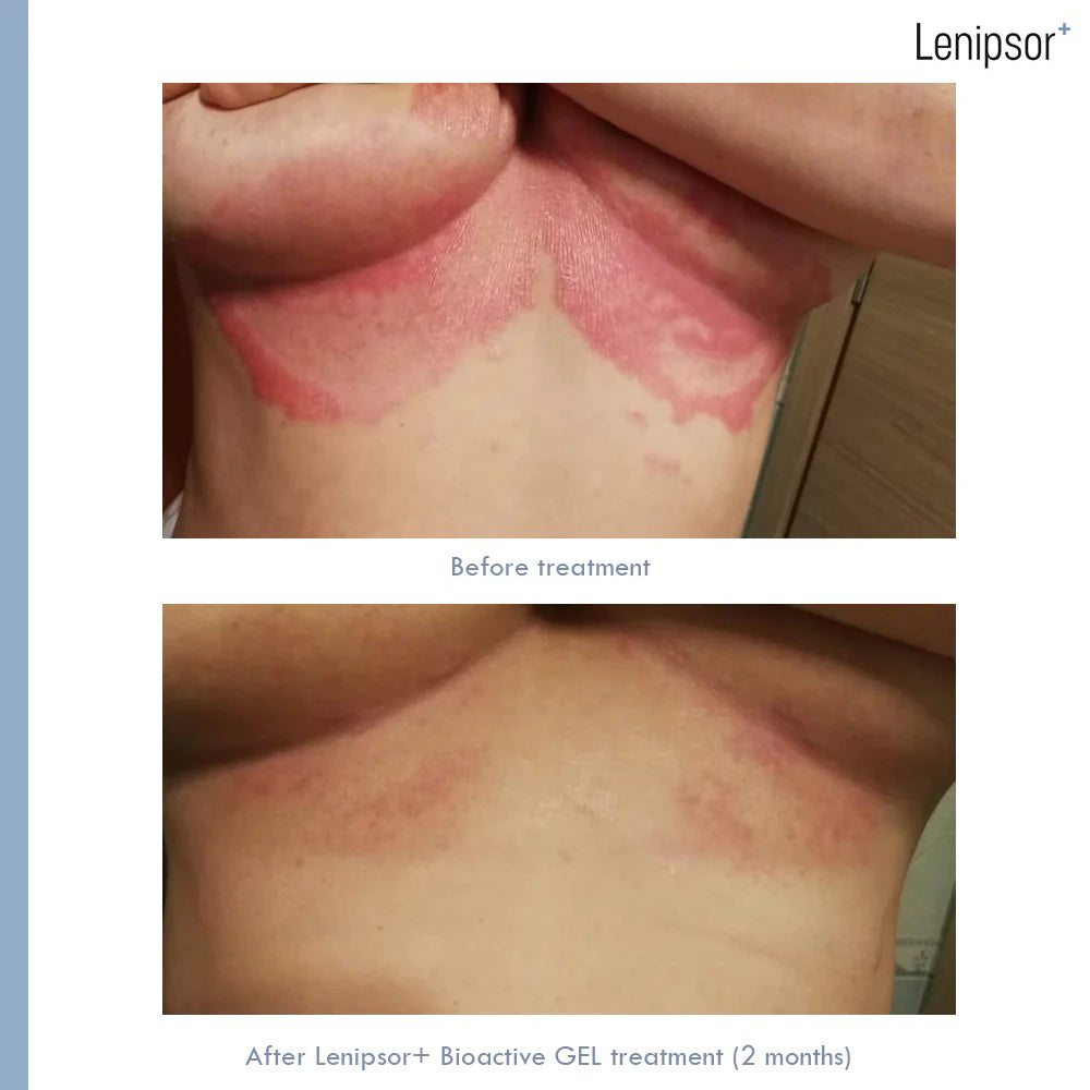 BioActive GEL Lenipsor+® 100 ml