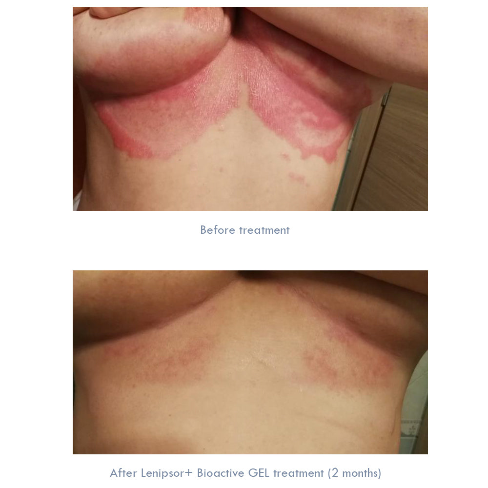 BioActive GEL Lenipsor+® 100 ml