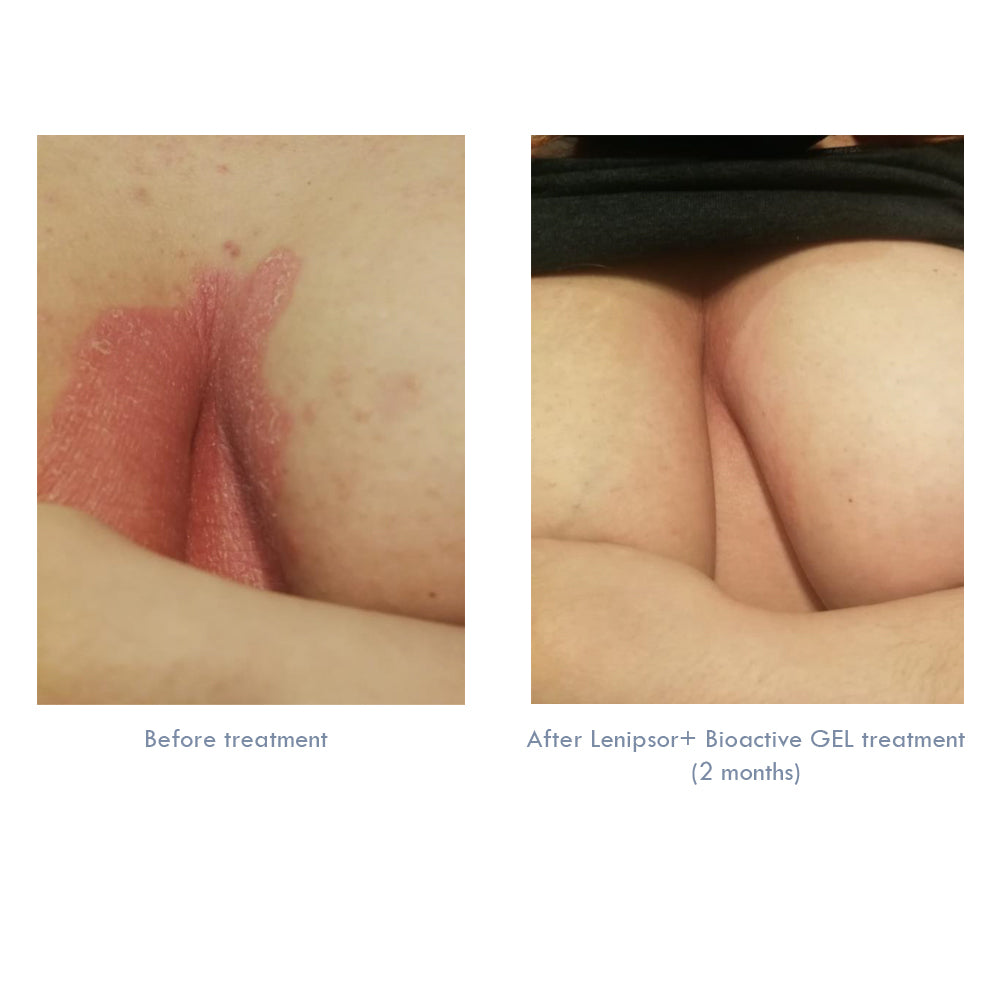 BioActive GEL Lenipsor+® 100 ml